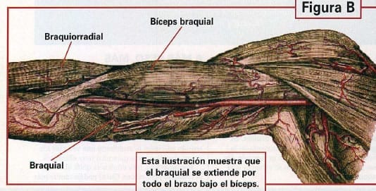 braquial