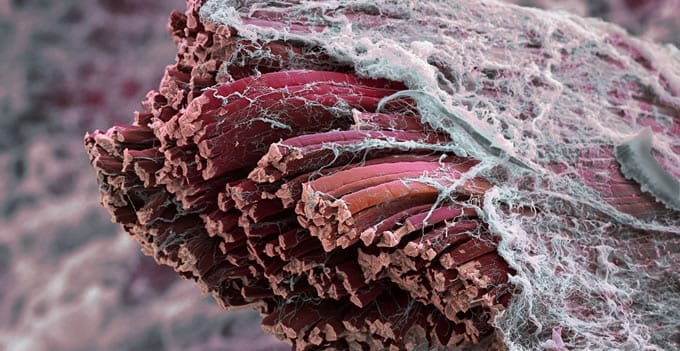 Fibras musculares con microscopio